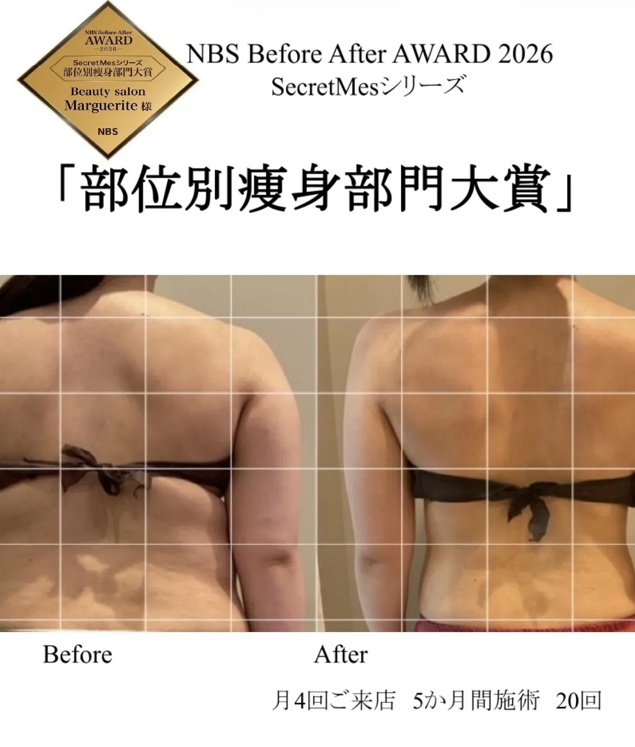 部位別痩身部門大賞
